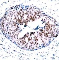 STAT5A (phospho Ser780) Antibody