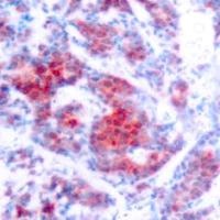 STAT4 (phospho Tyr693) Antibody