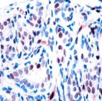 STAT3 (phospho Tyr705) Antibody