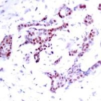 STAT1 (phospho Tyr701) Antibody