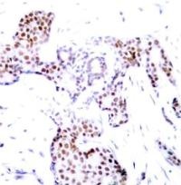 ELK1 Antibody