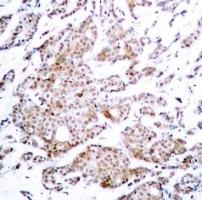 Myc (phospho Thr58) Antibody