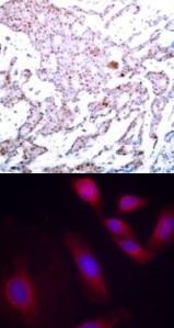 NFkB p65 (phospho Ser536) Antibody