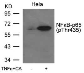 RELA Antibody
