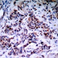 RELA Antibody