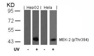 MAP2K2 Antibody