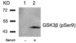 GSK3beta (phospho Ser9) Antibody