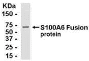 S100A6 Antibody