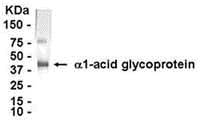ORM1 Antibody