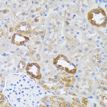 RNASEL Antibody