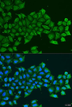 PDGFD Antibody