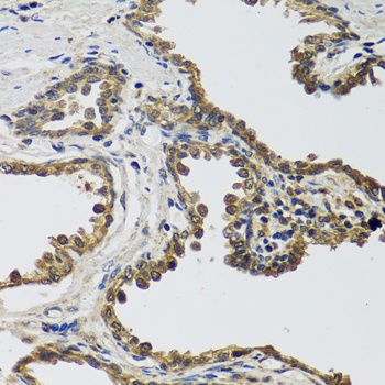 IL25 Antibody