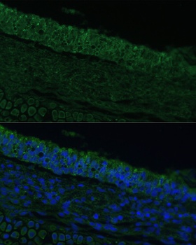 IL25 Antibody