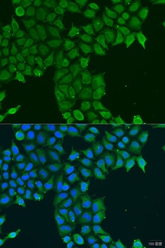 CDK16 Antibody