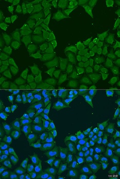 MAGEA6 Antibody