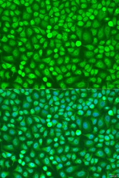 HOXB5 Antibody