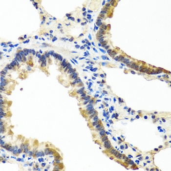 ANGPT1 Antibody