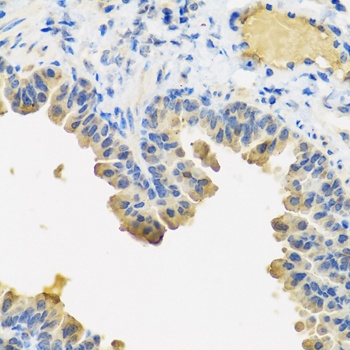 ANGPT1 Antibody