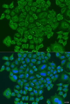 NDUFS7 Antibody