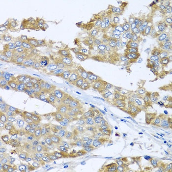 COQ7 Antibody