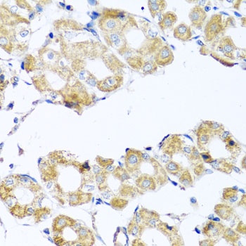 COQ7 Antibody