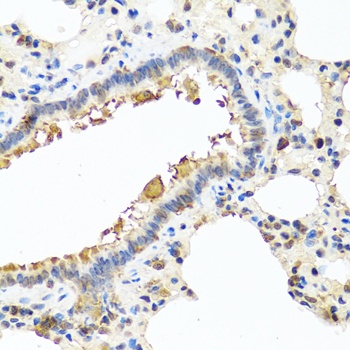 CHI3L2 Antibody