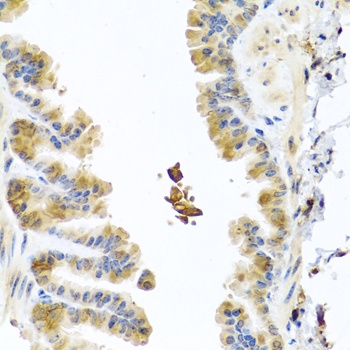 CHI3L2 Antibody