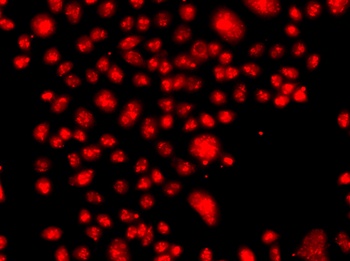 FANCM Antibody