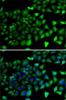 NFYB Antibody