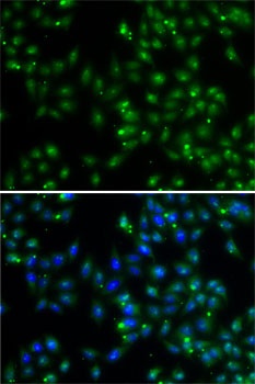 DUSP22 Antibody