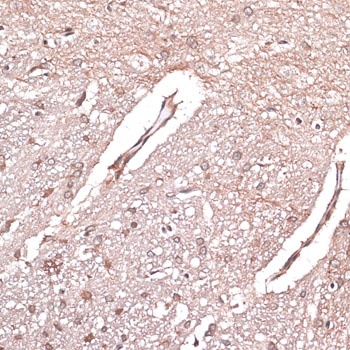 LMO4 Antibody
