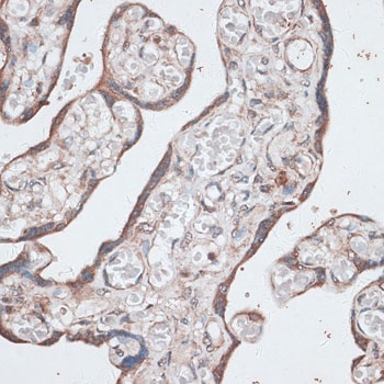 LMO4 Antibody