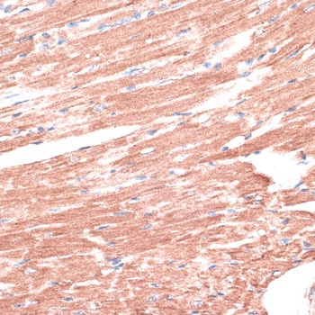 LMO4 Antibody