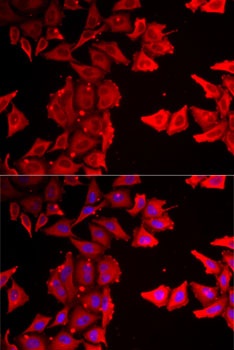 THRSP Antibody