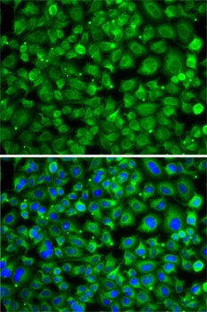 SAT2 Antibody