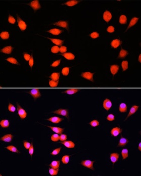 COMMD1 Antibody