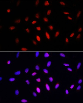 COMMD1 Antibody