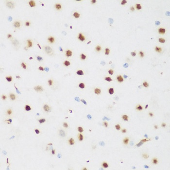 CSRNP1 Antibody