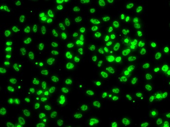 CSRNP1 Antibody