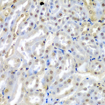 TUSC2 Antibody