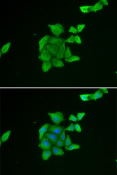 TUSC2 Antibody