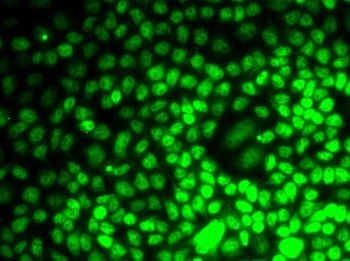 CCNE2 Antibody