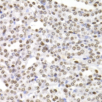 SOX5 Antibody