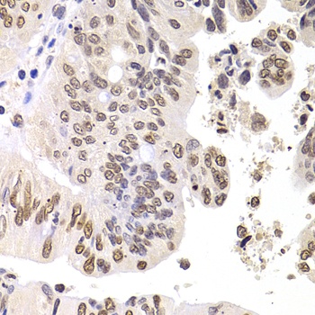 SOX5 Antibody