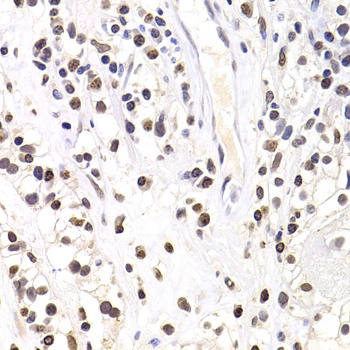 SOX5 Antibody