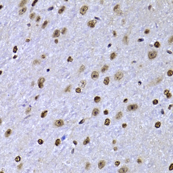 SOX5 Antibody