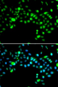 SRSF4 Antibody