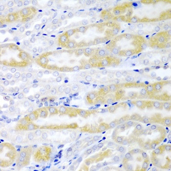 FABP6 Antibody