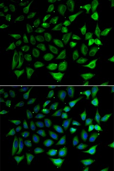 SLC25A20 Antibody