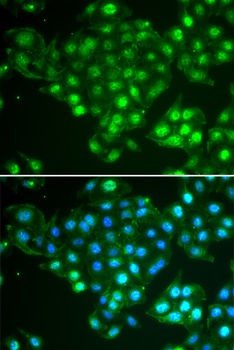 ABCA3 Antibody